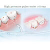 H23d5a461038d44ad88372815acfec677W.jpg Replacement Tips for Waterpik Periodontal Tips Dental Water Flosser Random Color
