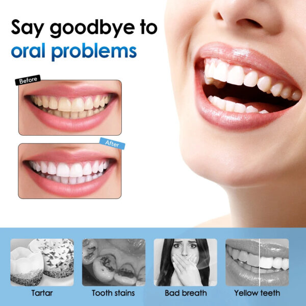 Electric Sonic Vibration Dental Scaler Teeth Whitening Plaque Calculus Coffee Smoke Stains Tartar Removal Toothbrush Tooth Clean