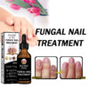 Eelhoe Nail Repair Solution Thickening and Shining Removal Dead Skin Eelhoe Nail Repair Solution Thickening and Shining Removal Dead Skin