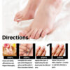 Eelhoe Nail Repair Solution Thickening and Shining Removal Dead Skin Eelhoe Nail Repair Solution Thickening and Shining Removal Dead Skin