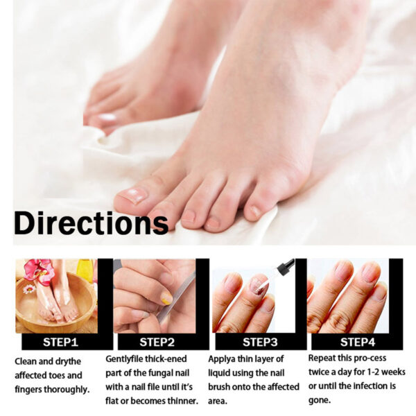 Eelhoe Nail Repair Solution Thickening and Shining Removal Dead Skin Eelhoe Nail Repair Solution Thickening and Shining Removal Dead Skin