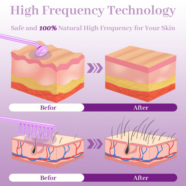 High Wave Electrotherapy Rod Frequency Beauty Instrument Eutic Appliance